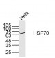 HSP70 Mouse mAb